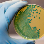 listeria-riski-yayiliyor-peynirde-kuresel-alarm-endisesi-yomk.jpg