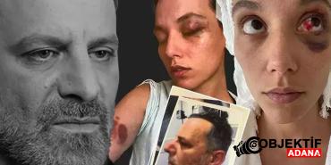 ozan-guvene-kadikoydeki-bir-mekanda-kadinlardan-tepki-failler-disari-llxn.jpg