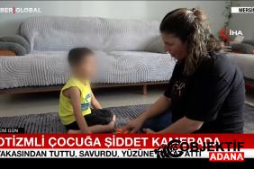 goruntuleri-izleyen-aile-soke-oldu-otizmli-cocuga-siddet-kamerada-gbsu.jpg