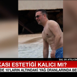 oguzhan-kocun-karin-kasi-estetik-mi-ri79.jpg
