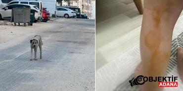 sanliurfada-basibos-kopek-dehseti-1-cocuk-yaralandi-srlp.jpg