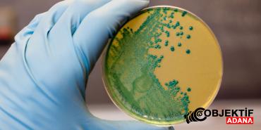 listeria-riski-yayiliyor-peynirde-kuresel-alarm-endisesi-yomk.jpg