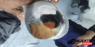 evine-donerken-kopeklerin-saldirisina-ugradi-basina-15-dikis-atildi-y8ks.jpg